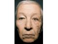 紫外線の肌への影響が如実に顔に表れた男性の画像！