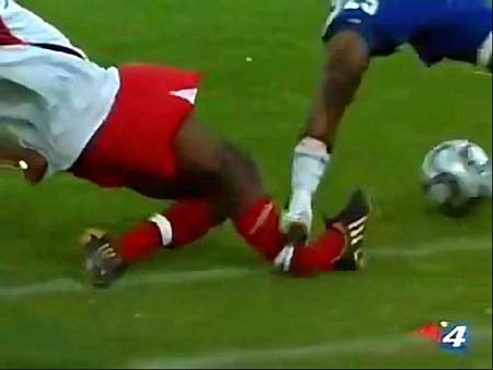 直視できない サッカーの恐怖の骨折シーン 画像あり 閲覧注意 ワールドサッカー道場 スポーツ まにあ道 趣味と遊びを極めるサイト