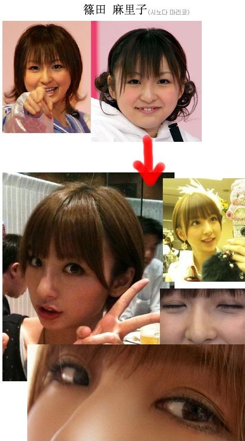 AKB48整形疑惑画像　篠田麻里子　あご鼻二重切開目頭切開目尻切開
